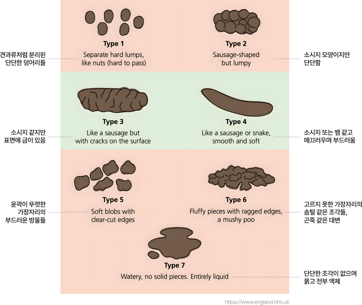 Type1 견과류처럼 분리된 단단한 덩어리들 / Type2 소시지 모양이지만 단단함 / Type3 소시지 같지만 표면에 금이 있음 / Type4 소시지 또는 뱀 같고 매끄러우며 부드러움 / Type5 윤곽이 뚜렷한 가장자리의 부드러운 방울들 / Type6 고르지 못한 가장자리의 솜털 같은 조각들, 곤죽 같은 대변 / Type7 단단한 조각이 없으며 묽고 전부 액체 / https://www.england.nhs.uk