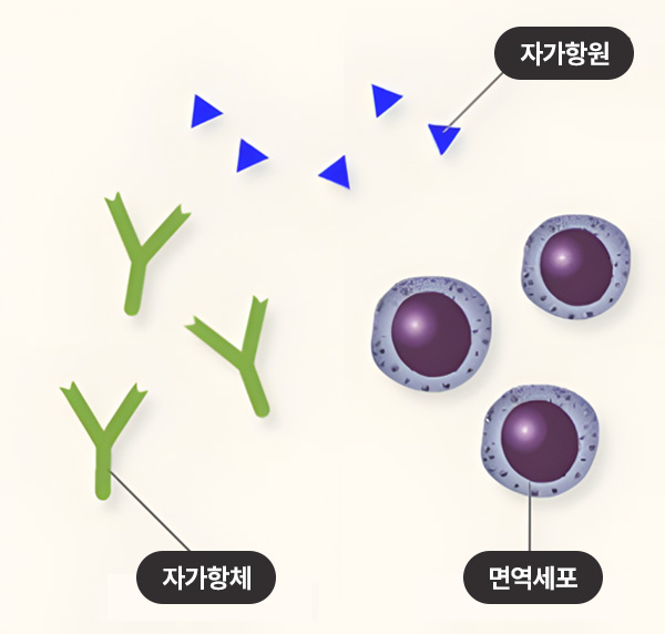 자가항원 / 자가항체 / 면역세포